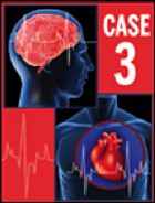Case 3: An 80-Year-Old Woman with Atrial Fibrillation and Multiple Cardiovascular Risk Factors – EXPIRED