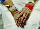 Hospital IV therapy may drain Medicare Part D, news analysis finds