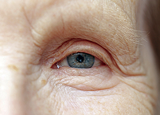 Injectable drugs decrease risk of blindness-related nursing home admission by nearly 20%, researchers find