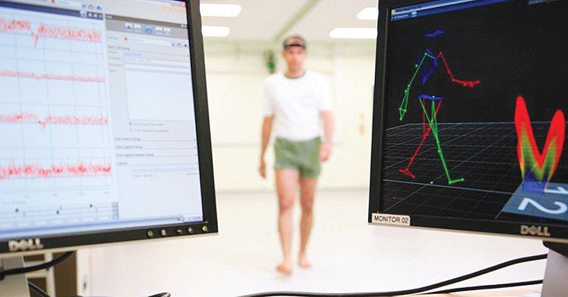 Body sensors able to tip off gait, Alzheimer’s risk: study