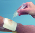 Saljet offers a cost-effective way to clean wounds in long-term care settings