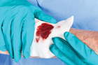 High-tech wound dressing  is shown to fight infection