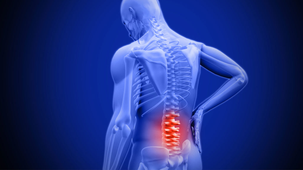 Adults 65 and older are in a lot of pain, particularly back pain, CDC learns