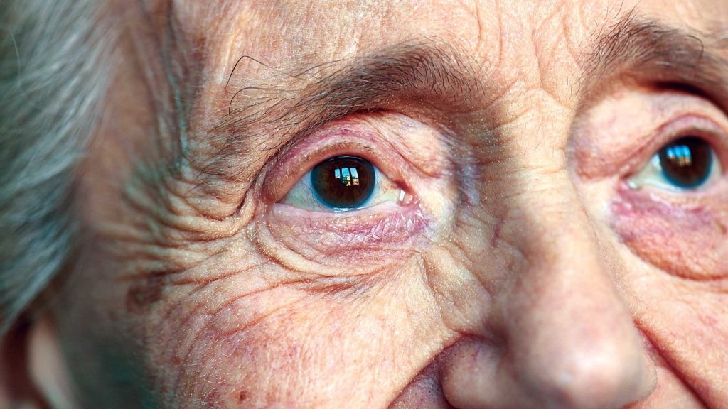 Eye drop corrects late-life vision loss in trial; Allergan reports patients’ feedback