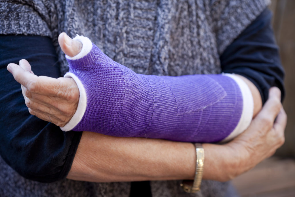 Recent falls can worsen fracture risk among women, study finds