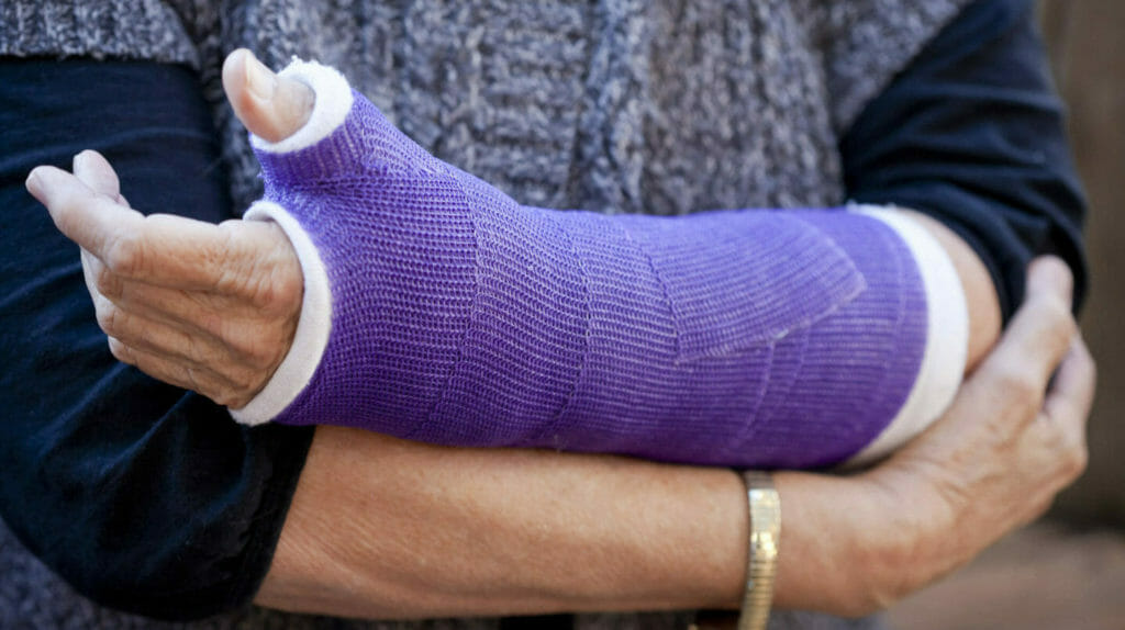 Study: Half of people with osteoporosis don’t get details on fracture risk, but they want it 