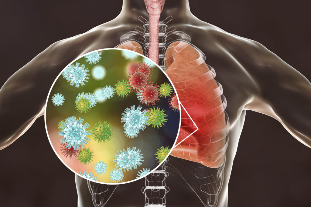 Study links 3 key risk factors to coronavirus deaths among older adults