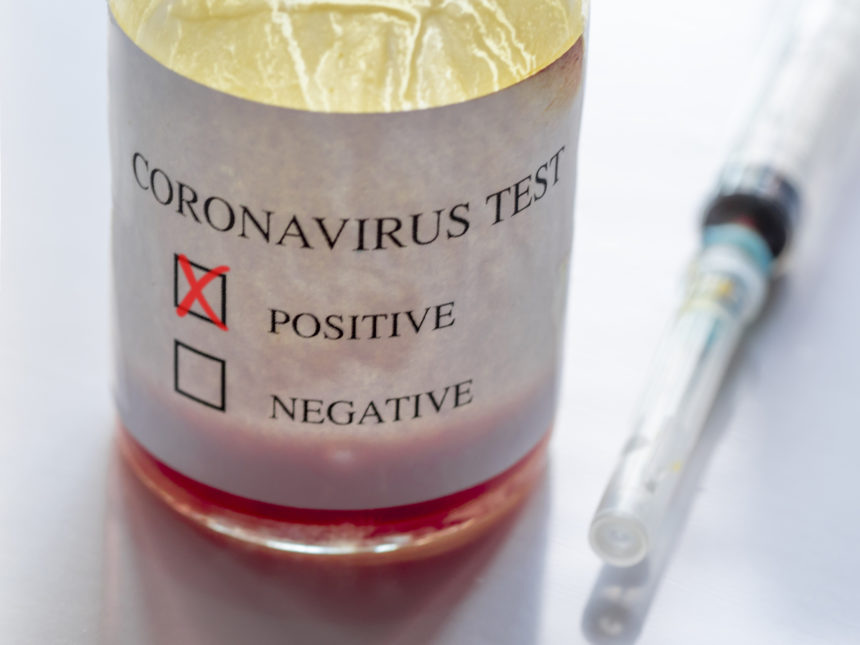 COVID-19 test bottle marked 'positive' next to sealed nasal swab