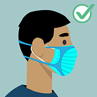 Rendering of a man wearing a medical mask modified with a brace for additional protection