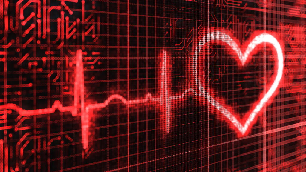 AI that helps screen for heart disease could be boon for LTC