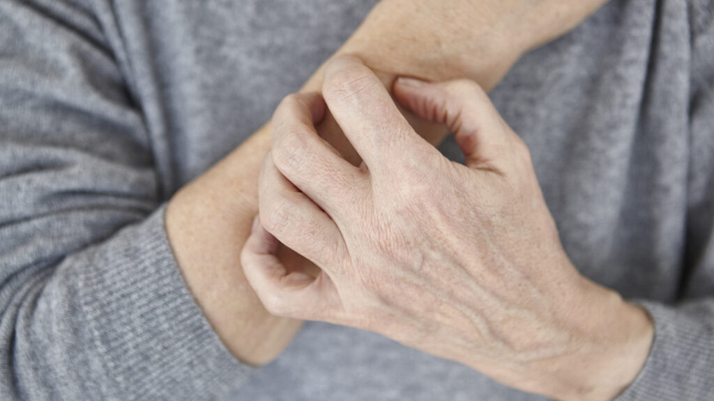 Tralokinumab safe for older adults’ eczema
